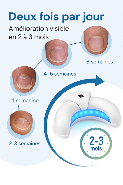 LUMICOSE